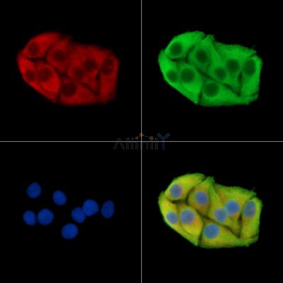 PPME1 Antibody - DF15470 staining Hela cells by IF/ICC.