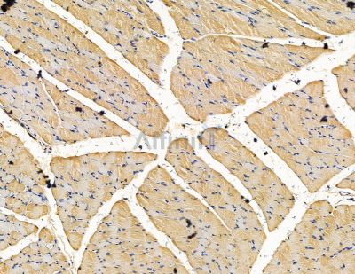 PPME1 Antibody - DF15470 at 1/100 staining rat muscle tissue by IHC-P.