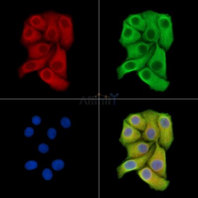 RABAC1 Antibody - DF15474 staining Hela cells by IF/ICC.