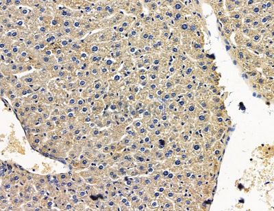 RABAC1 Antibody - DF15474 at 1/100 staining mouse liver tissue by IHC-P.