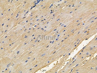 CRIP2 Antibody - DF15494 at 1/100 staining mouse heart tissue by IHC-P.