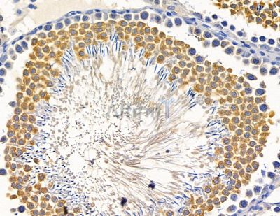 NEDD1 Antibody - DF15500 at 1/100 staining rat testis tissue by IHC-P.