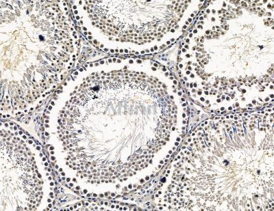 CTC1 Antibody - DF15502 at 1/100 staining rat testis tissue by IHC-P.