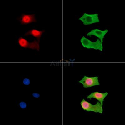 CTC1 Antibody - DF15502 staining HepG2 cells by IF/ICC.
