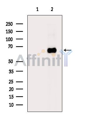 MPP2 Antibody - Western blot analysis of extracts from Rat liver, using MPP2 Antibody.
