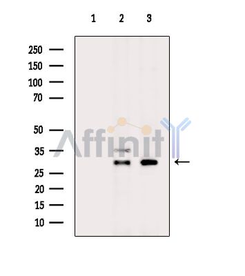 SPINT2 Antibody - Western blot analysis of extracts from various samples, using SPINT2 Antibody.