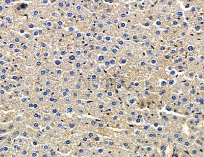 GMIP Antibody - DF15525 at 1/100 staining mouse liver tissue by IHC-P.