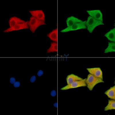 MON1A Antibody - DF15530 staining HepG2 cells by IF/ICC.