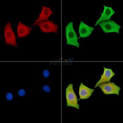 CLYBL Antibody - DF15532 staining HepG2 cells by IF/ICC.