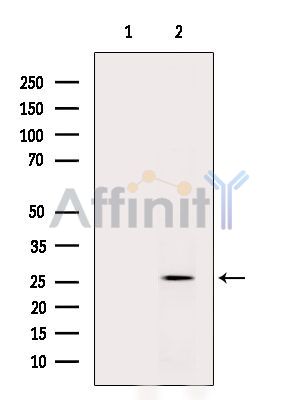 TEX35 Antibody - Western blot analysis of extracts from Rat liver, using TEX35 Antibody.