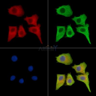 TEX35 Antibody - DF15538 staining HepG2 cells by IF/ICC.