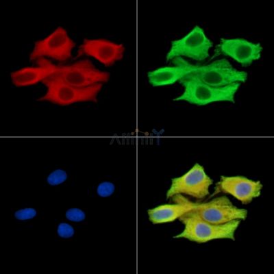 UBE2G2 Antibody - DF15540 staining HepG2 cells by IF/ICC.