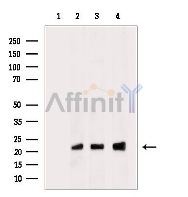RYBP Antibody - Western blot analysis of extracts from various samples, using RYBP Antibody.