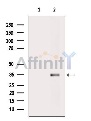 CSPS Antibody - Western blot analysis of extracts from Hela cells(heat-shock treatment), using CSPS Antibody.
