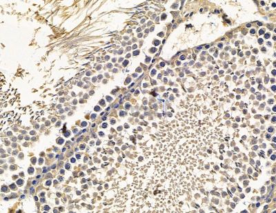 CSPS Antibody - DF15553 at 1/100 staining rat testis tissue by IHC-P.