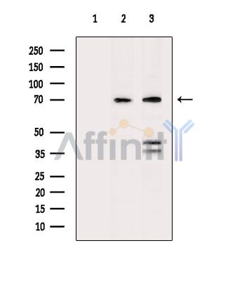 CDKL3 Antibody - Western blot analysis of extracts from various samples, using CDKL3 Antibody.