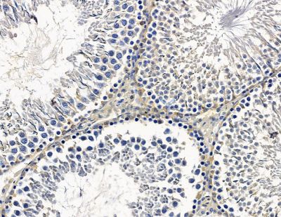 CDKL3 Antibody - DF15556 at 1/100 staining rat testis tissue by IHC-P.