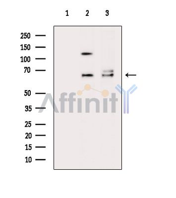 FOXJ2 Antibody - Western blot analysis of extracts from various samples, using FOXJ2 Antibody.