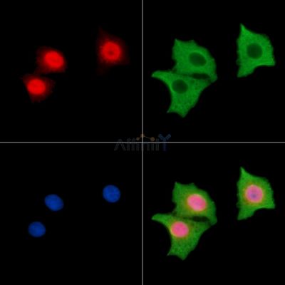 FOXJ2 Antibody - DF15560 staining HepG2 cells by IF/ICC.