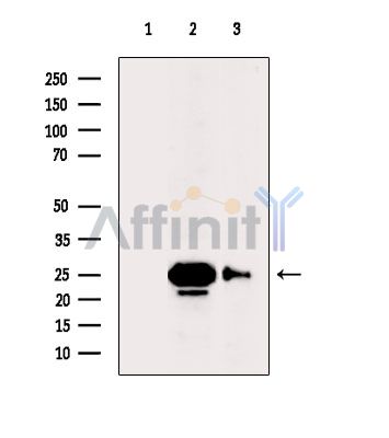 ZNF365 Antibody - Western blot analysis of extracts from various samples, using ZNF365 Antibody.