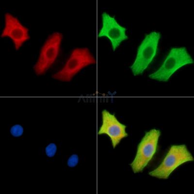 SLC17A3 Antibody - DF15562 staining HepG2 cells by IF/ICC.