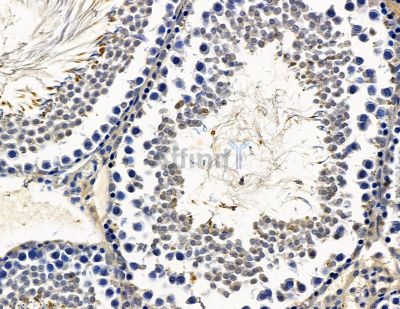 RAX Antibody - DF15564 at 1/100 staining rat testis tissue by IHC-P.