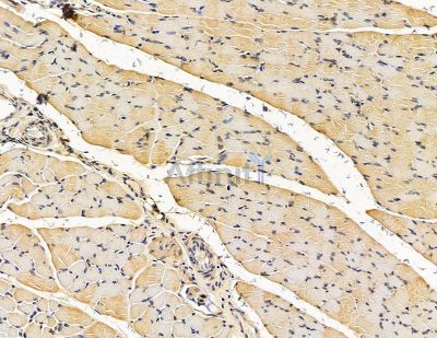 TSNAX Antibody - DF15568 at 1/100 staining rat muscle tissue by IHC-P.