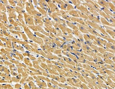 ATF6B Antibody - DF15572 at 1/100 staining rat heart tissue by IHC-P.