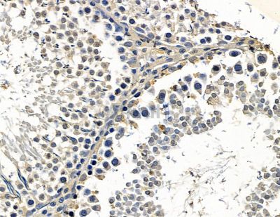 ZNF683 Antibody - DF15586 at 1/100 staining rat testis tissue by IHC-P.