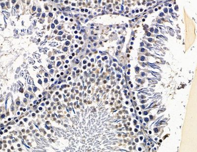 DEDD2 Antibody - DF15588 at 1/100 staining rat testis tissue by IHC-P.