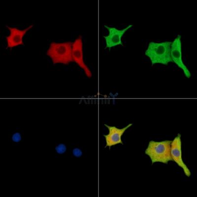 MPDU1 Antibody - DF15603 staining HepG2 cells by IF/ICC.