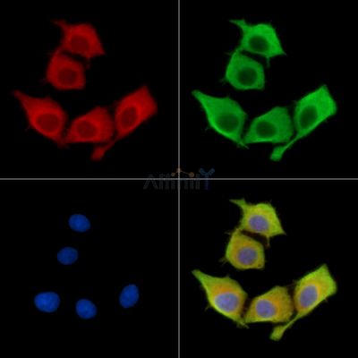 SPPL2B Antibody - DF15613 staining HepG2 cells by IF/ICC.