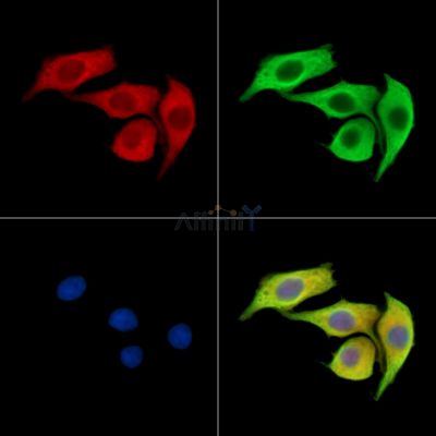 CAPN15 Antibody - DF15614 staining HepG2 cells by IF/ICC.