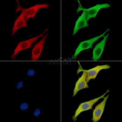 CORT Antibody - DF15620 staining HepG2 cells by IF/ICC.