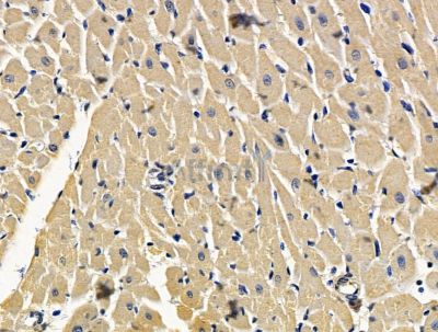 CORT Antibody - DF15620 at 1/100 staining rat heart tissue by IHC-P.
