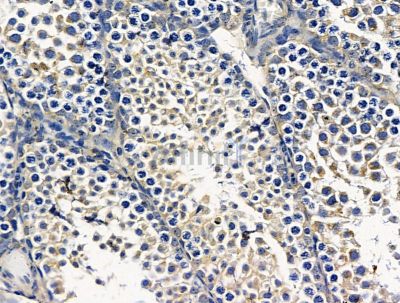 PENK Antibody - DF15623 at 1/100 staining mouse testis tissue by IHC-P.