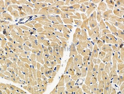 PENK Antibody - DF15623 at 1/100 staining rat heart tissue by IHC-P.