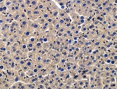 ZP3 Antibody - DF15626 at 1/100 staining mouse liver tissue by IHC-P.