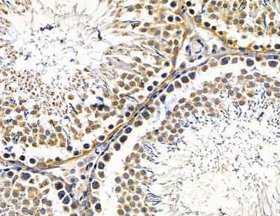ZNF16 Antibody - DF15645 at 1/100 staining rat testis tissue by IHC-P.