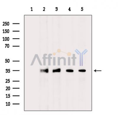 TLX2 Antibody - Western blot analysis of extracts from various samples, using TLX2 Antibody.