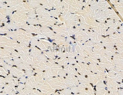 TLX2 Antibody - DF15646 at 1/100 staining rat muscle tissue by IHC-P.