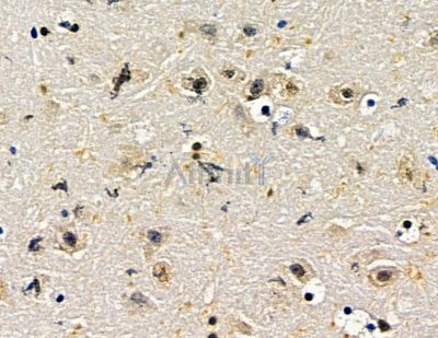 ZNF382 Antibody - DF15647 at 1/100 staining mouse brain tissue by IHC-P.