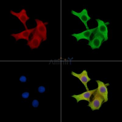 TRABD Antibody - DF15651 staining HepG2 cells by IF/ICC.