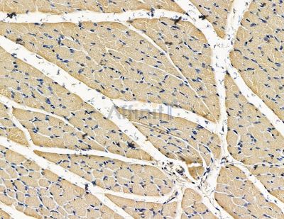 TRABD Antibody - DF15651 at 1/100 staining rat muscle tissue by IHC-P.