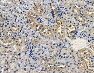 RBP7 Antibody - DF15653 at 1/100 staining mouse kidney tissue by IHC-P.
