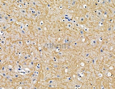 FBXW4 Antibody - DF15654 at 1/100 staining mouse brain tissue by IHC-P.