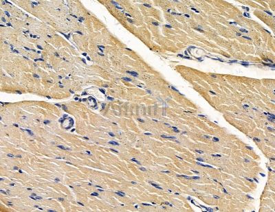 GPHRA/B Antibody - DF15655 at 1/100 staining rat muscle tissue by IHC-P.