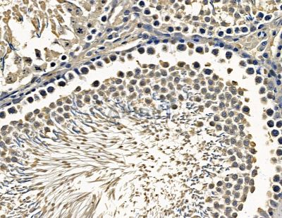 CUL9 Antibody - DF15657 at 1/100 staining rat testis tissue by IHC-P.