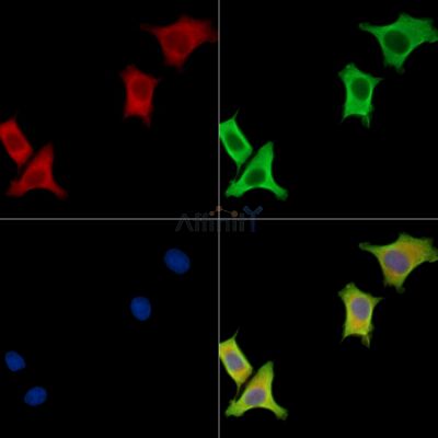 MOSPD3 Antibody - DF15658 staining HepG2 cells by IF/ICC.