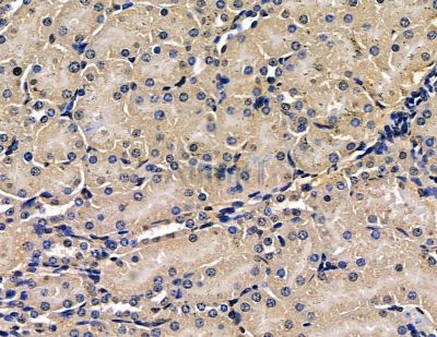 LDLRAP1 Antibody - DF15664 at 1/100 staining mouse kidney tissue by IHC-P.